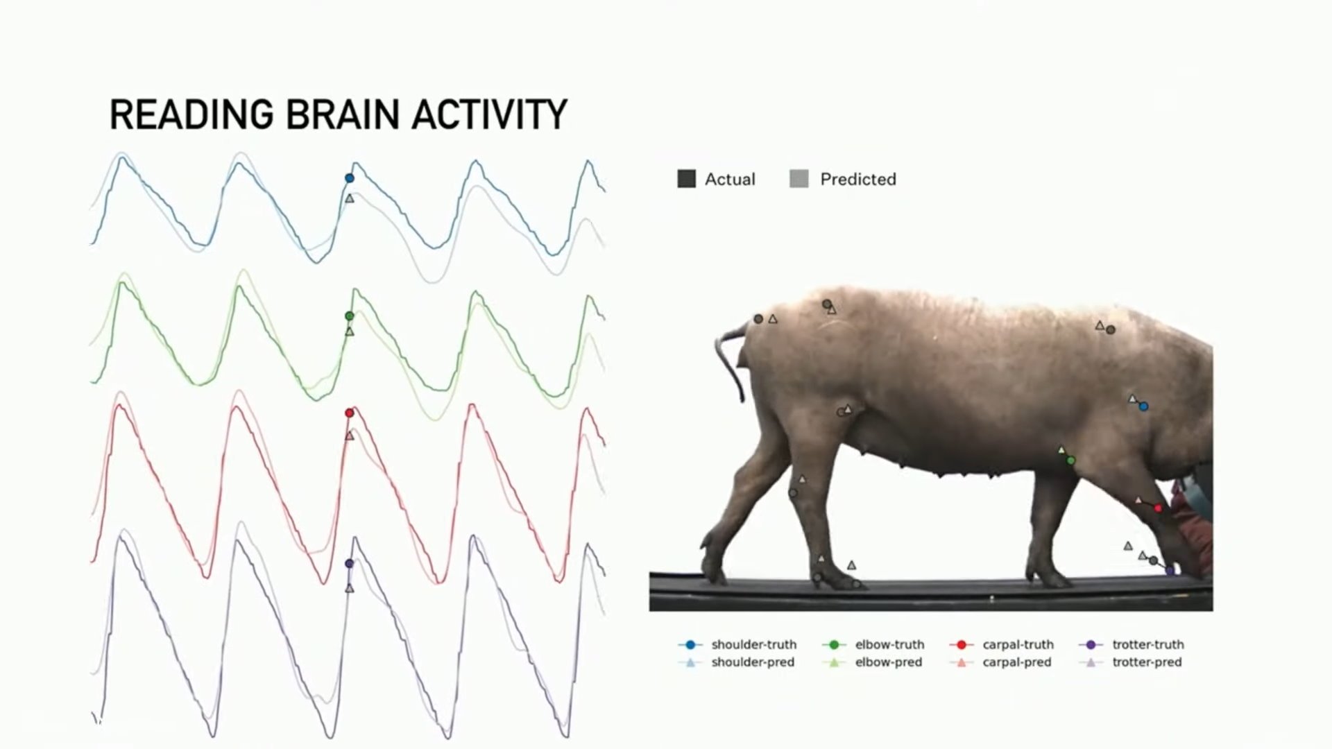 neuralink implant